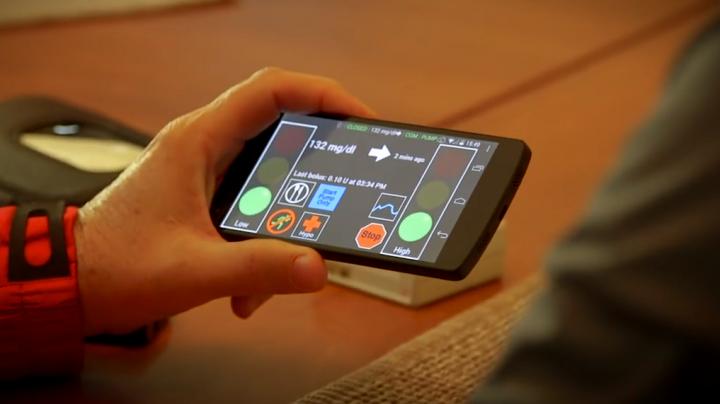 Artificial Pancreas Set To Begin Final Tests