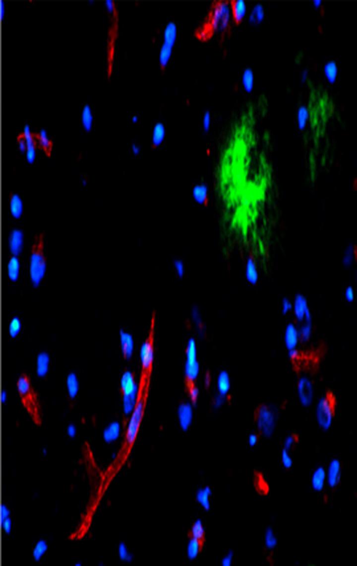 Uncovering a Way for Amyloid to Exit the Brain (4 of 6)