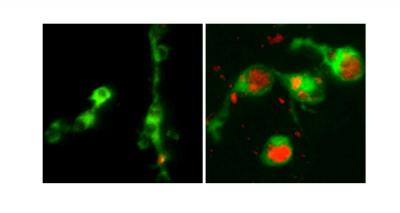 Normal and 'Clogged' Macrophages