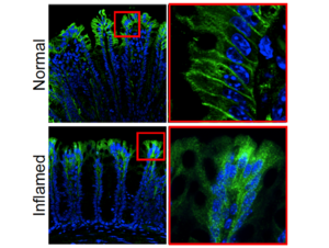 PAR2 in normal and inflamed tissue