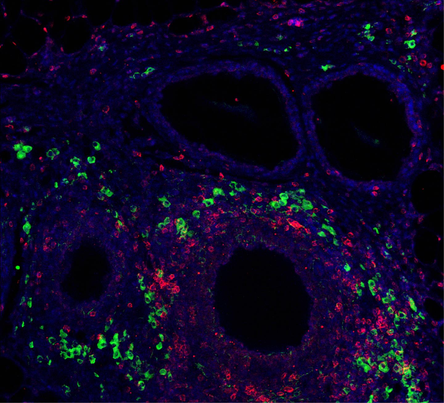 Synthetic Hydrogel Material