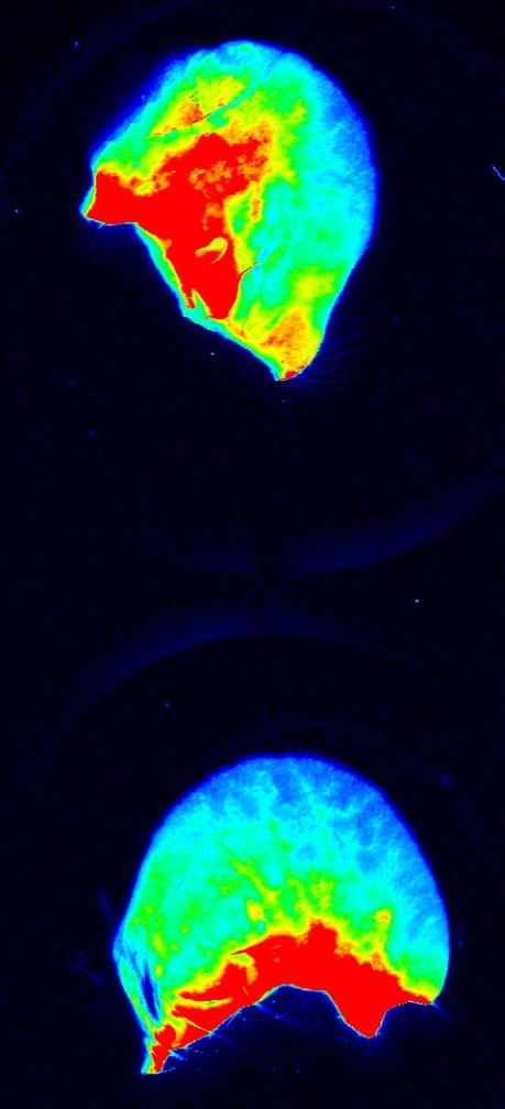 Mosquito Saliva Increases Disease Severity Following Dengue Virus Infection