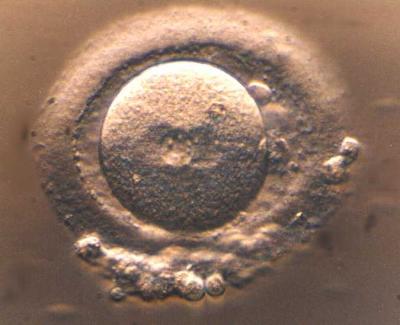 Fertilized Human Egg, Prior to Division