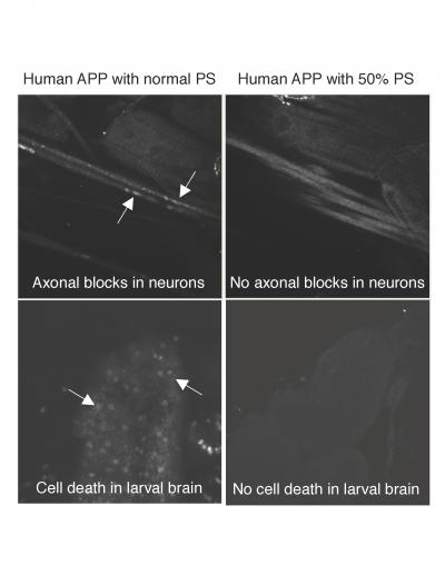 Presenilin and Its Effect on Traffic in Neurons
