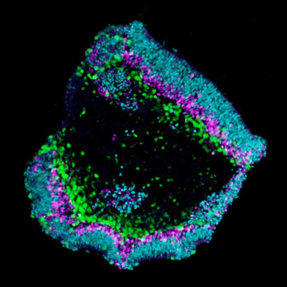 Retina Organoid Crossection