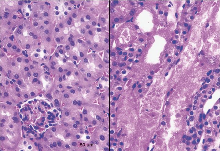 Normal vs. Injured Kidney Tissue