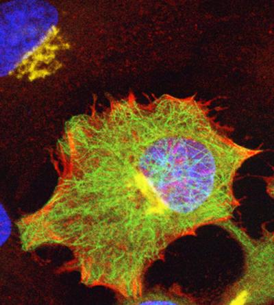 Cells in the Limelight