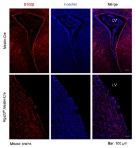 Rgs22-deficiency results in dysfunction of ependymal cells