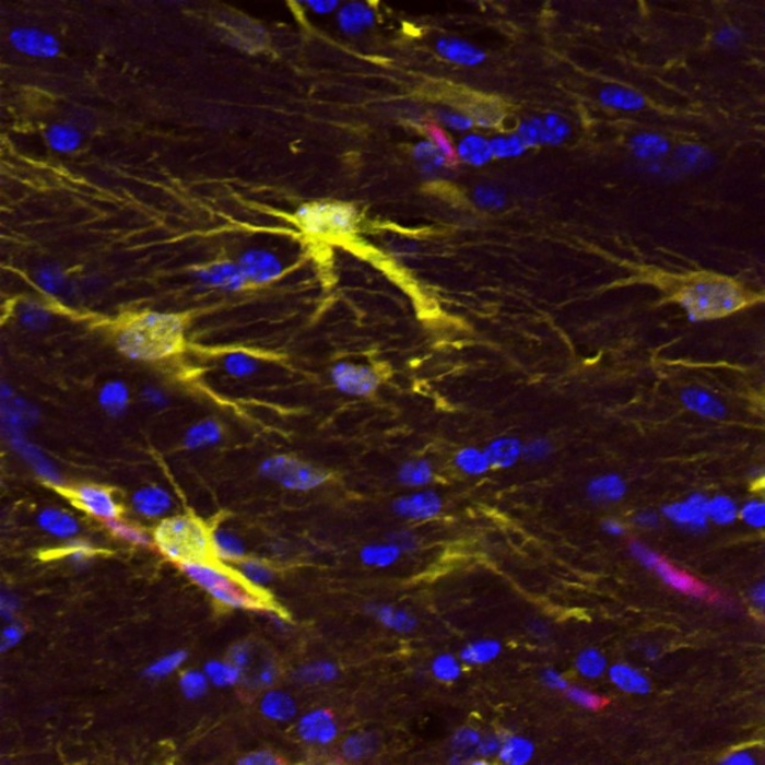 Astrocytes within regenerating mouse brain tissue