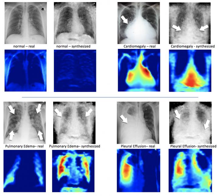 X-ray images