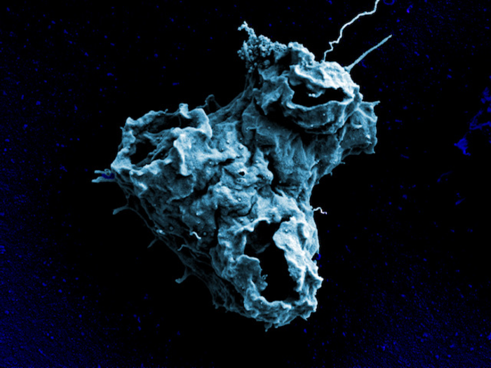 The cell surface of a Naegleria gruberi amoeba visualized by scanning electron microscopy.