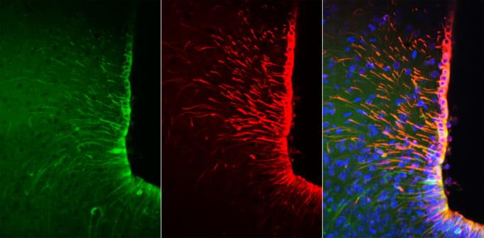 Tanycytes