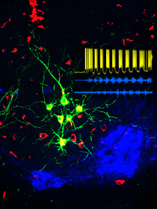 Spinocerebellar tract neurons in mice