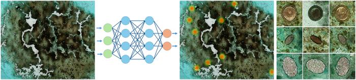 Image-based artificial intelligence spots parasitic worm infections in children's stool samples