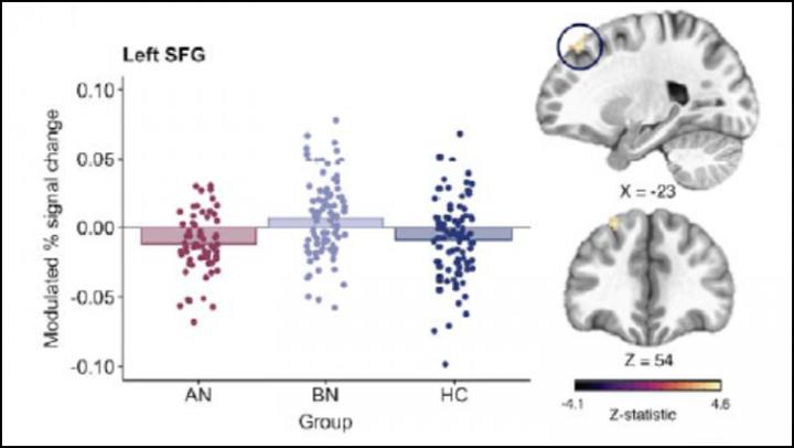 Binge-Eating Is Not Caused by Stress-Induced Impulsivity