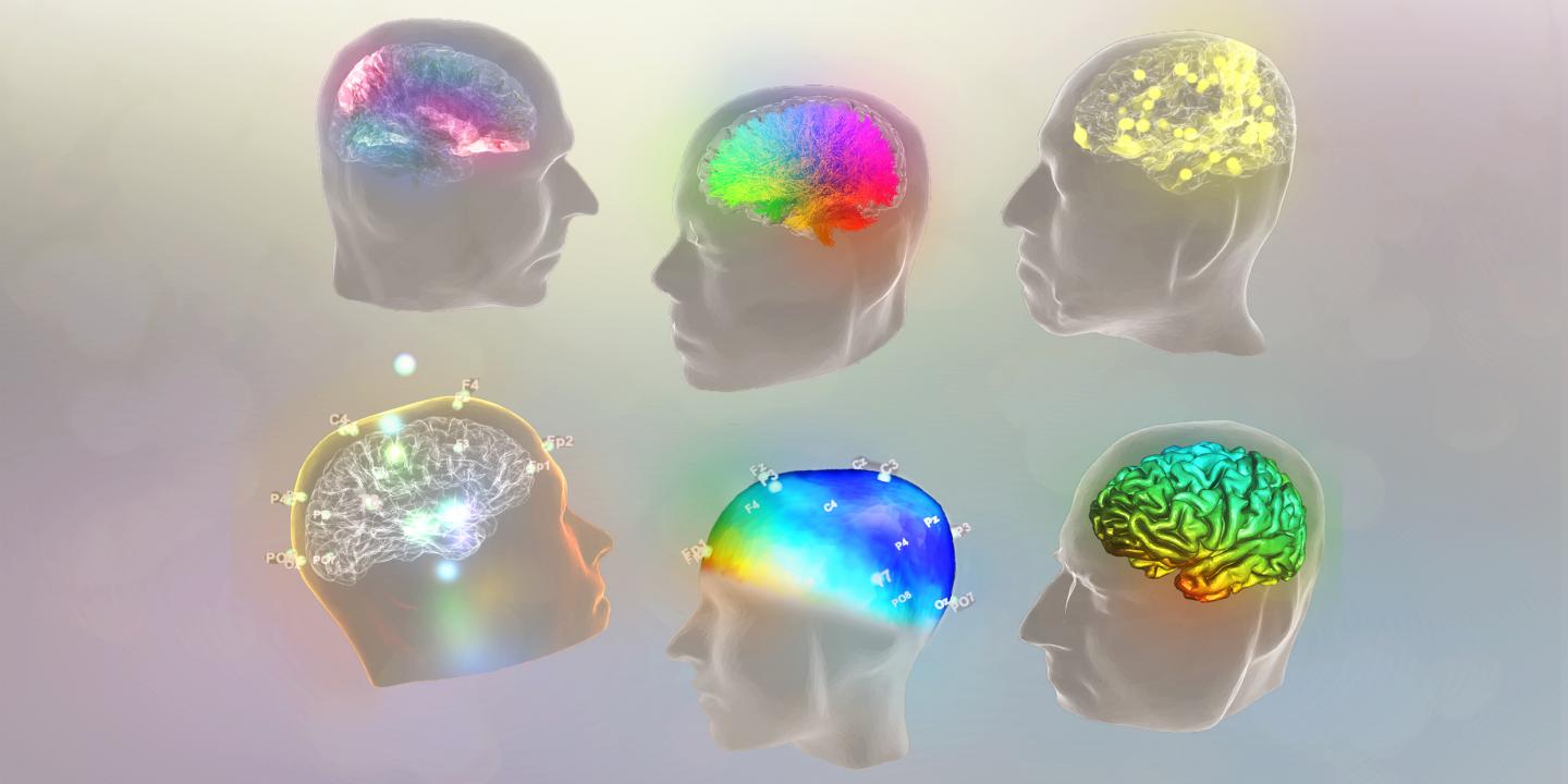 Simulations Produced using the Virtual Brain Software