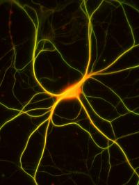 Expressing Neuron
