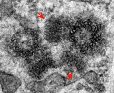 Extra Centriole Production Without Breakdown of Plk4