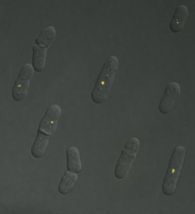 How Dicer Protects the Yeast Genome from Damage