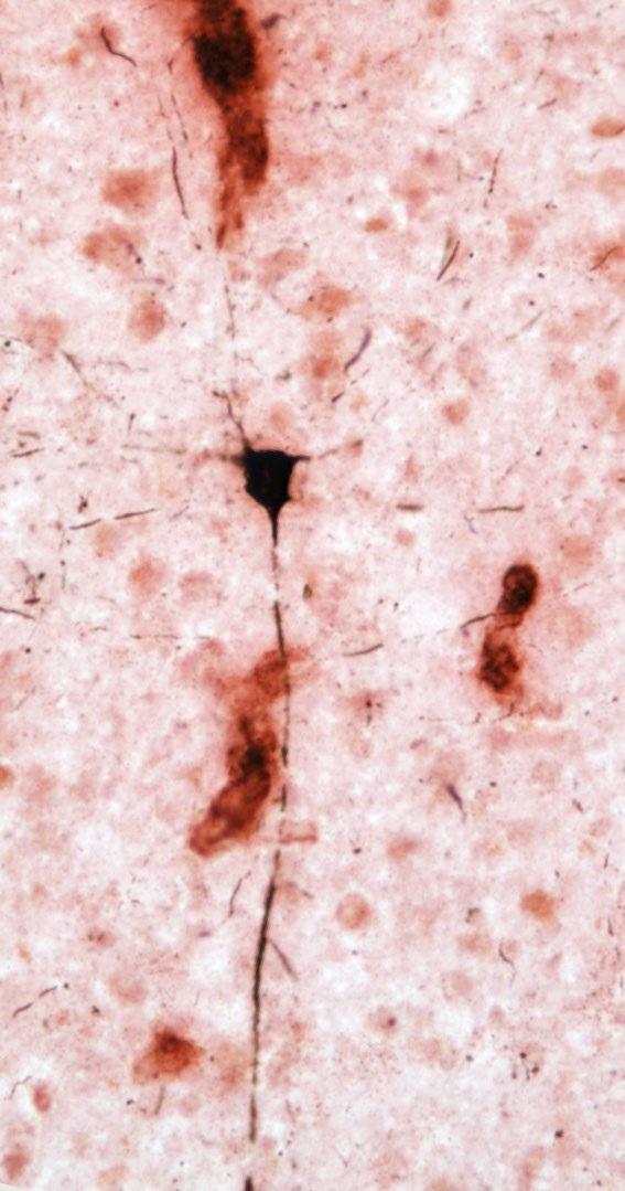 Photo from Aged Chimpanzee Brain