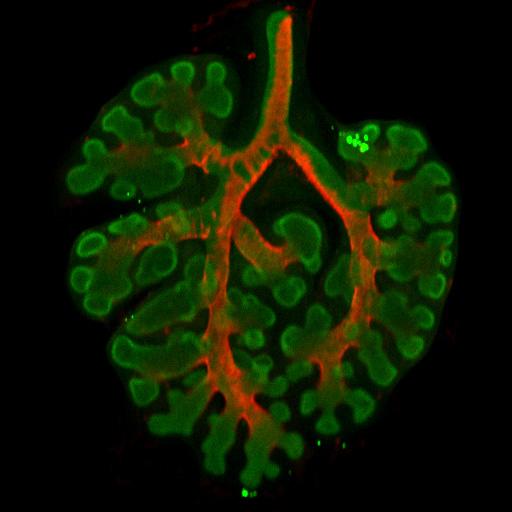 Branches in Lung Development