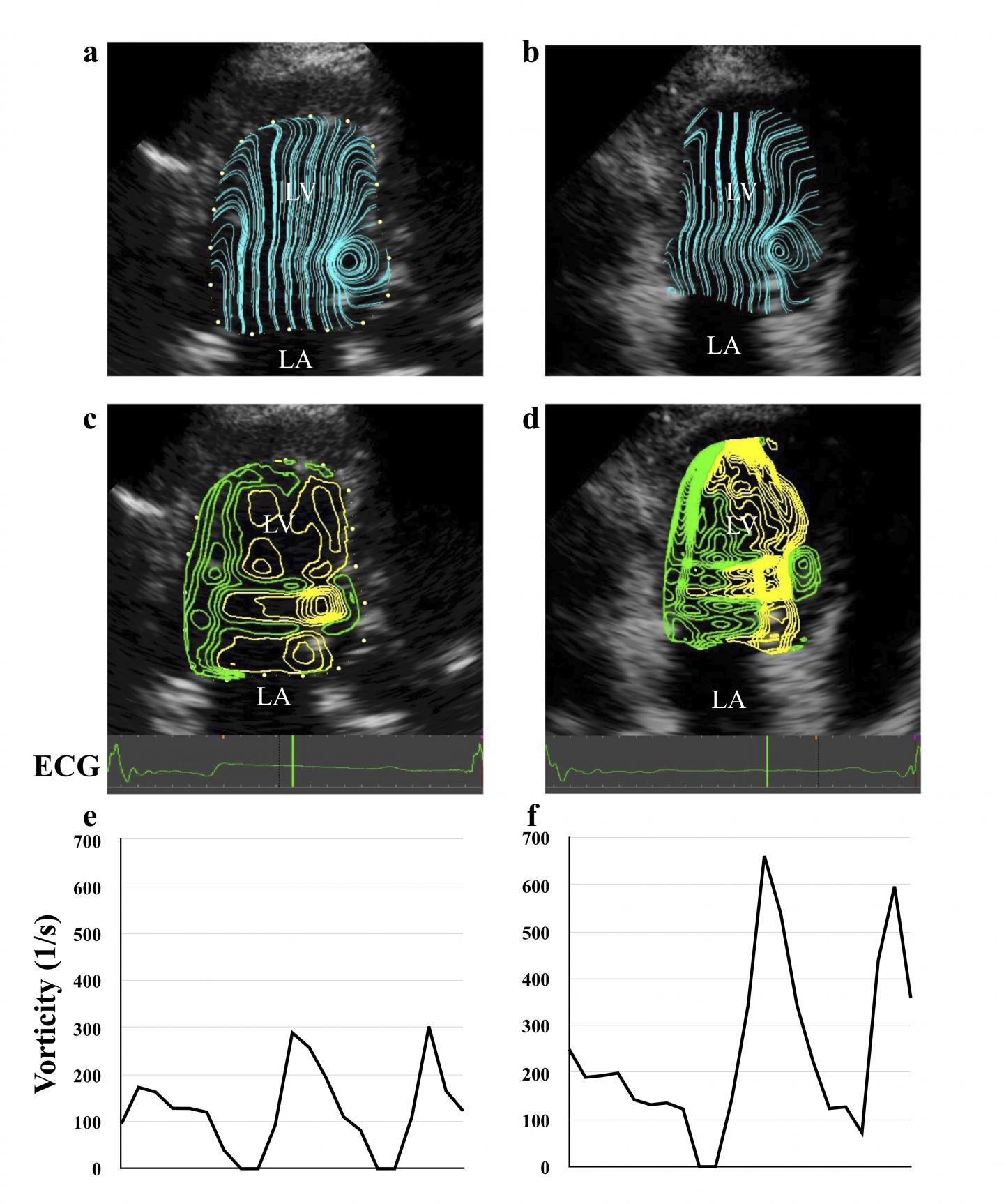 Vortex flows of blood in a large heart (a, c, e) and a small heart (b, d, f) of healthy dogs