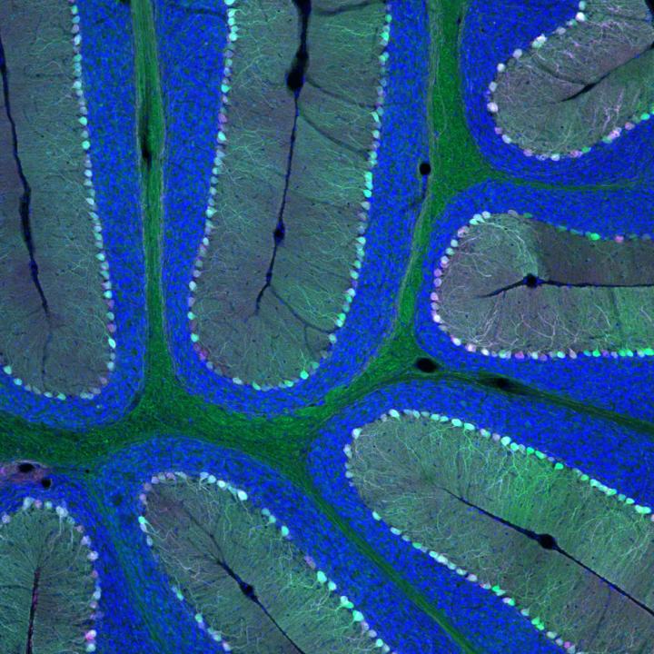 Delivering Genes Across the Blood-Brain Barrier (2 of 2)