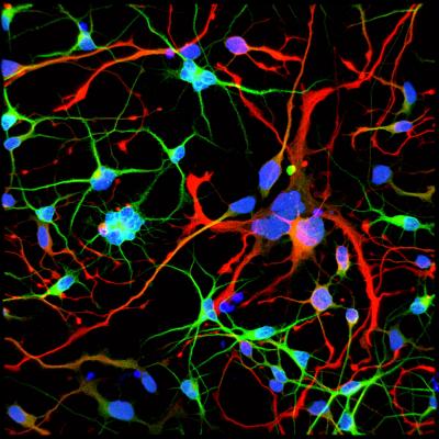 Huntington's Neurons