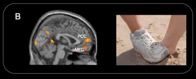 Intentional Pain Causes Brain Response