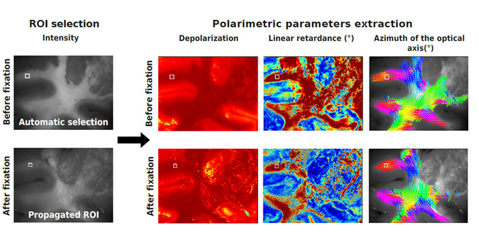 Comparing the polarimetric properties of fresh and preserved brain tissue