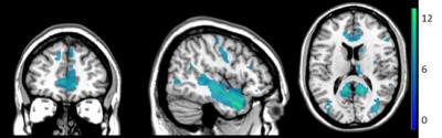 Areas in the Network of Brain Regions that Deactivate During Self-touch