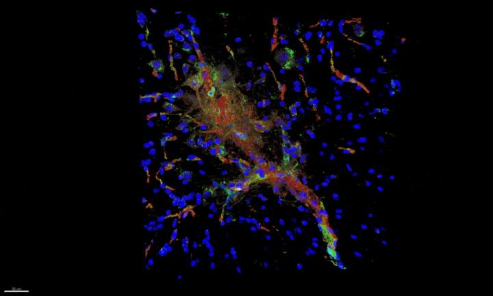 Neuroinflammation in ALS