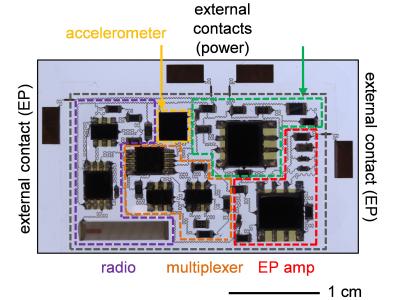 Miniaturized Mobile Health Monitoring (5 of 9)