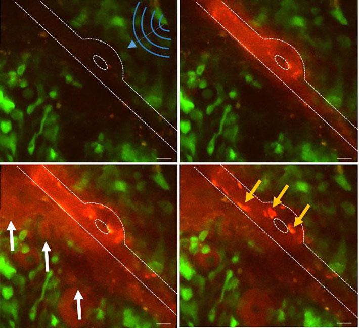 Sequential Intravital Multiphoton Microscopy of An Autofluorescence Chemotherapeutic Agent