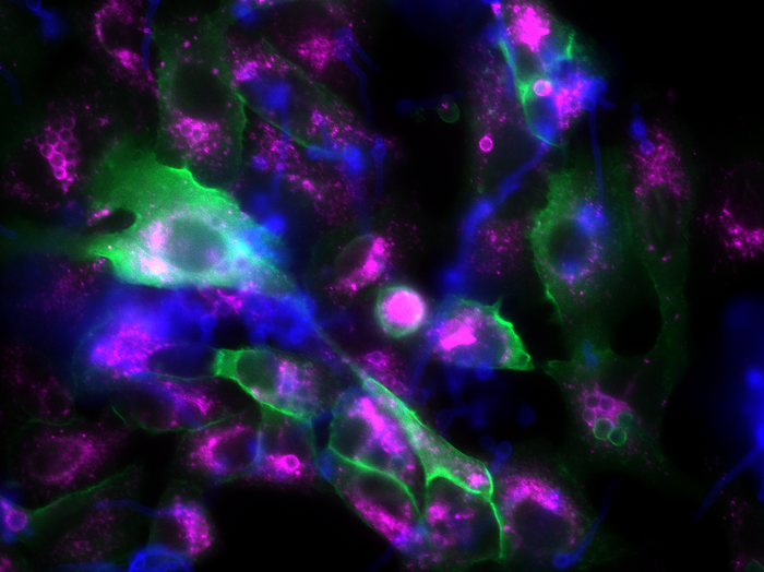 Lung cells taking up fungal spores