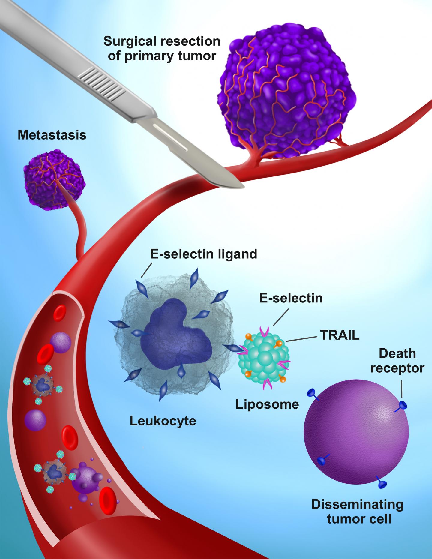 Upgraded Molecule May Reduce Post-Surgical Metastasis, Mouse Study Shows (2 of 3)