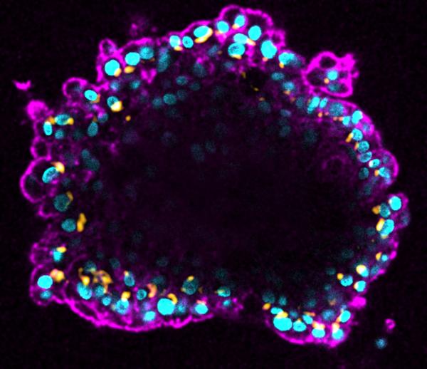 Cancer: Central Role Of Cell 'skeleton' Discovered