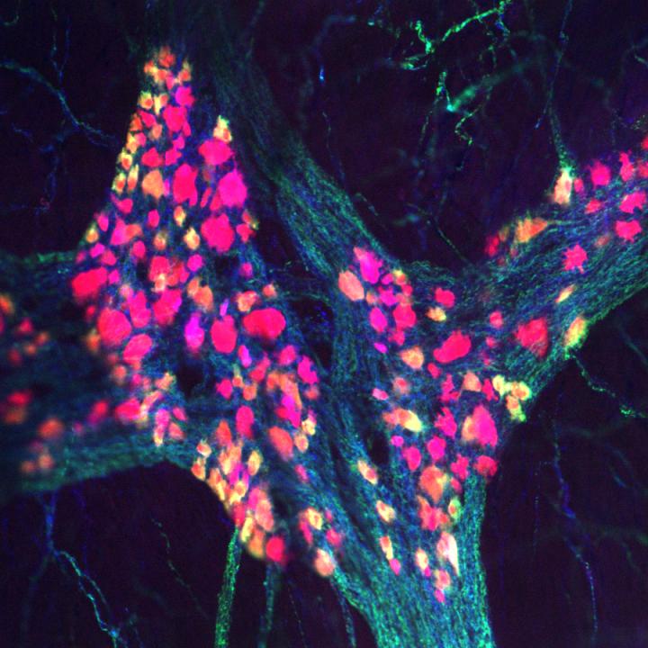 3-D view of Enteric Nervous System