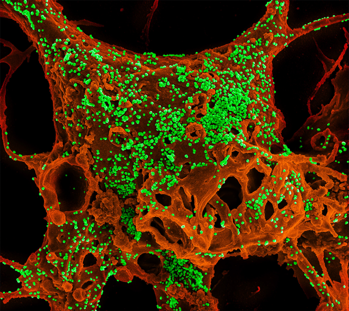 Photo of cells infected by MERS