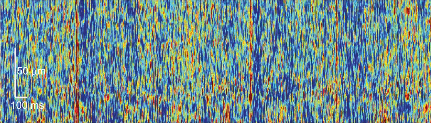 Input Pattern to a Purkinje Neuron in the Awake Animal