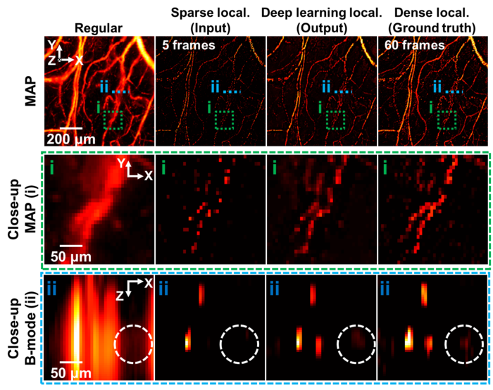 Deep Learning-Based 3D Label-free Localization Optical-Resolution Photoacoustic Microscopy.