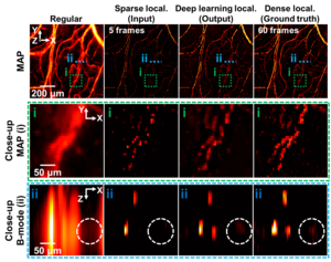 Deep Learning-Based 3D Label-free Localization Optical-Resolution Photoacoustic Microscopy.