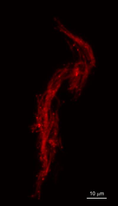 Mycobacteria Growing in Zebrafish