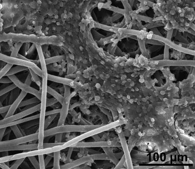 Ewing's Sarcoma Cells