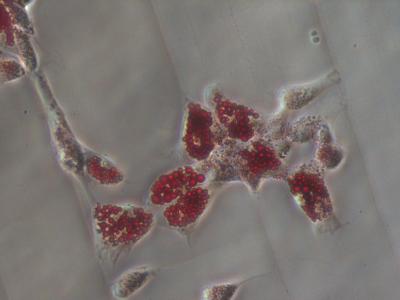 Matrix Stiffness Essential to Stem Cell Differentiation (3 of 3)