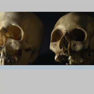 Teeth of Skeletal Remains