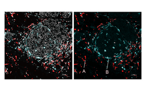 New Method Precisely Locates Gene Activity and Proteins Across Tissues