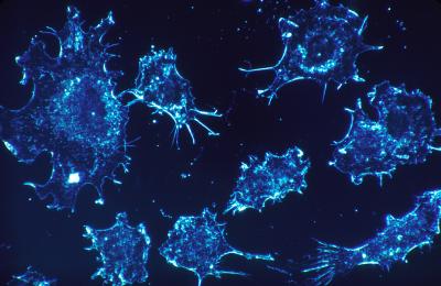 Strategy Discovered to Activate Genes that Suppress Tumors and Inhibit Cancer