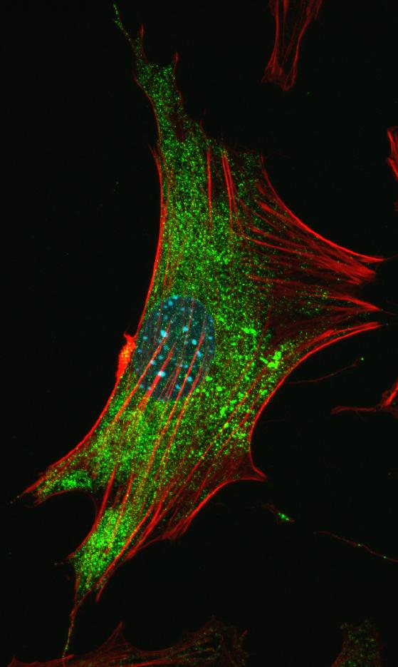 FMRP in Mouse Astrocyte