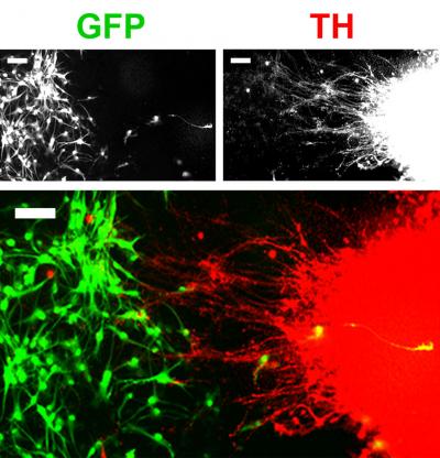 Researchers Develop New Technique for Modeling Neuronal Connectivity Using Stem Cells